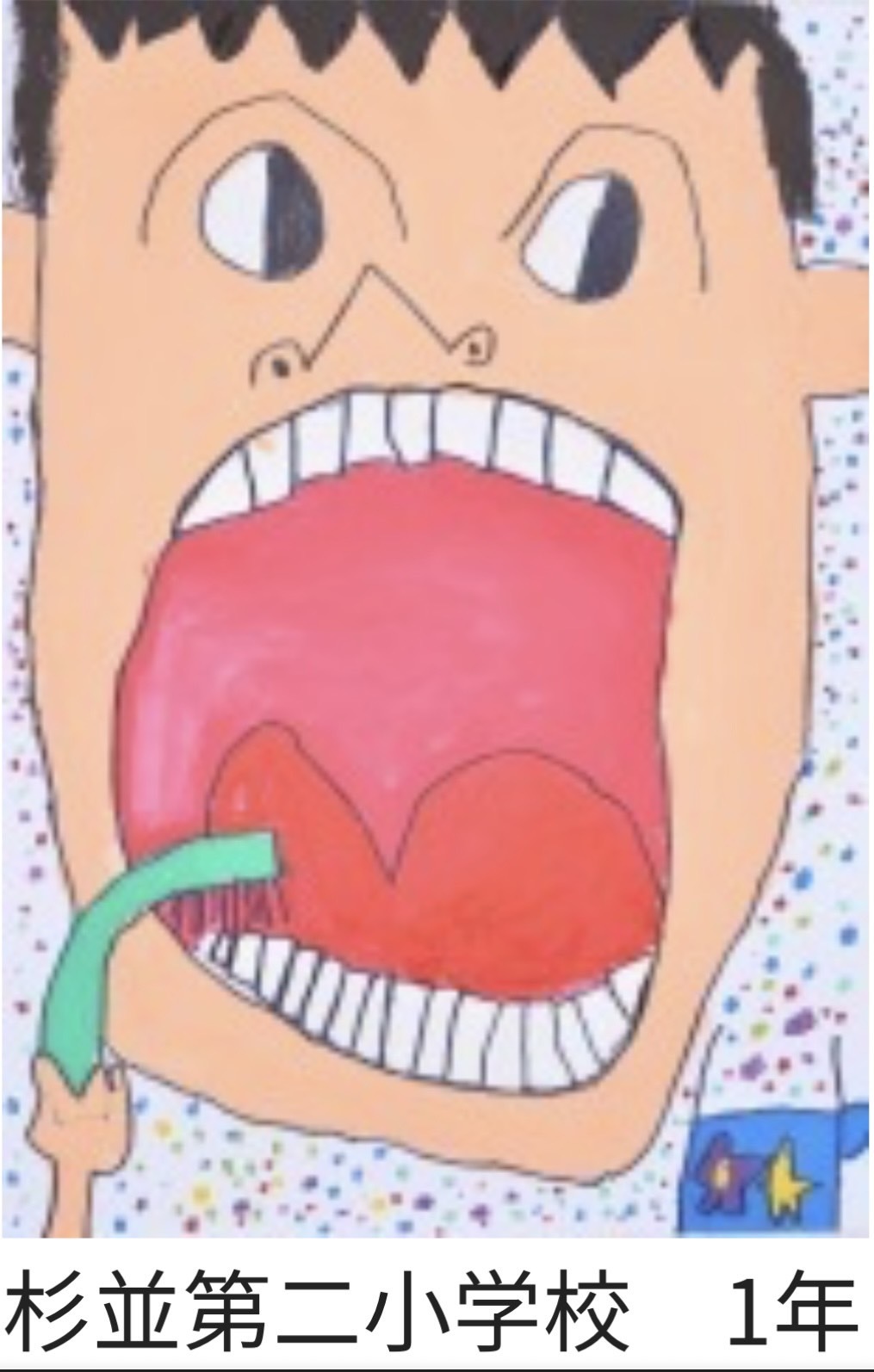 歯科健診①